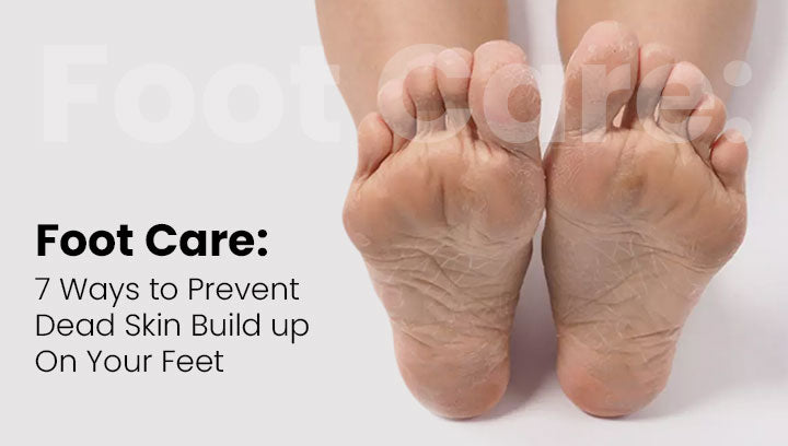 Foot Care: 7 Ways to Prevent Dead Skin Build up On Your Feet
