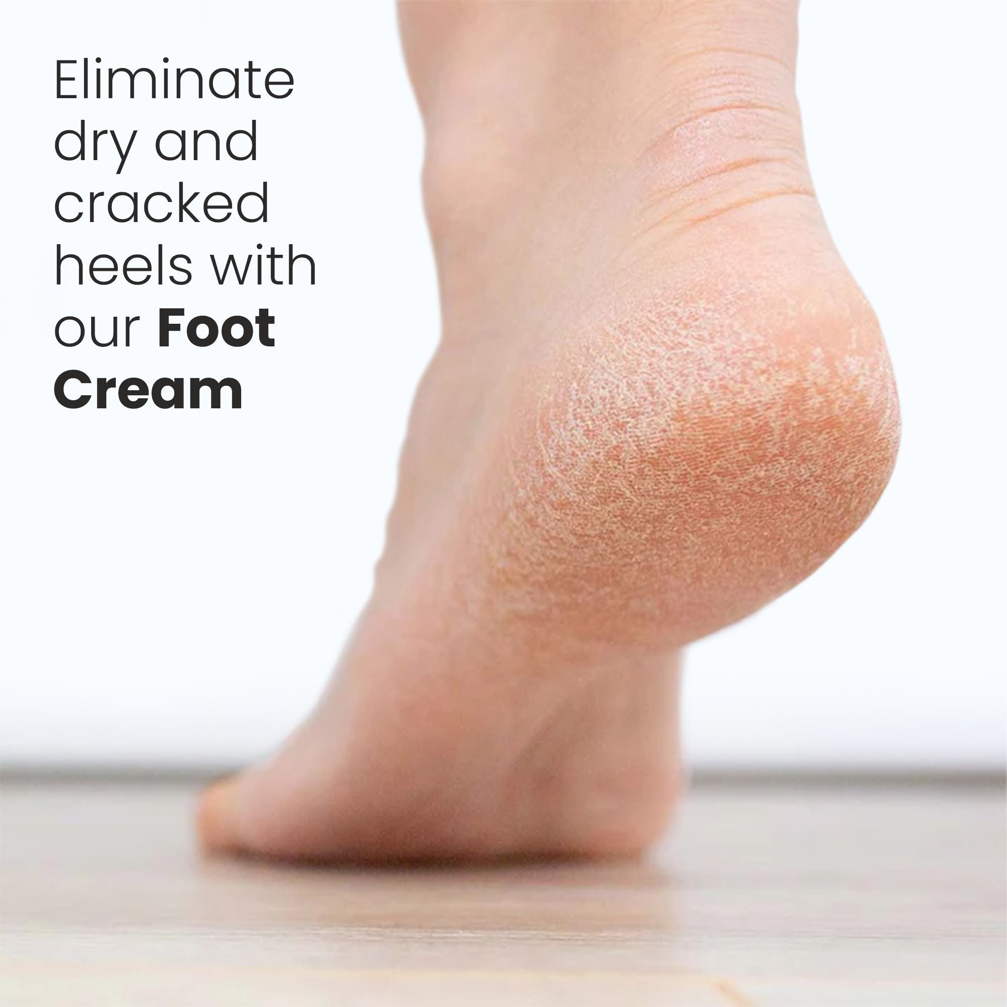 Uniqaya Foot Care Cream for dry and cracked heels