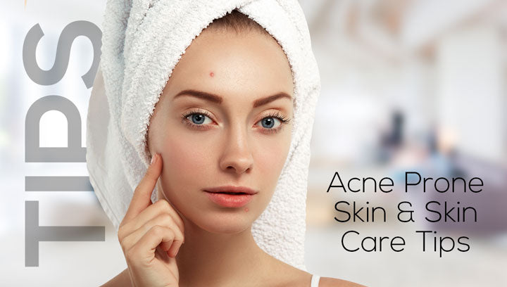 About Acne Prone Skin & Skin Care Tips That Helps