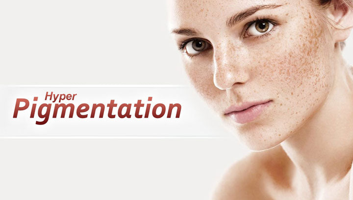 Skincare Routine that helps in Hyperpigmentation