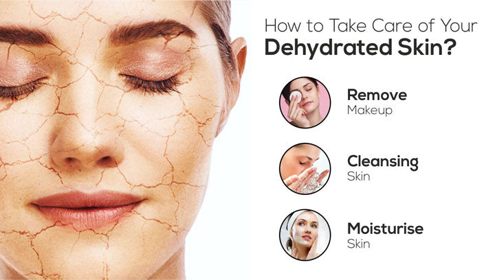 How to Take Care of Your Dehydrated Skin?