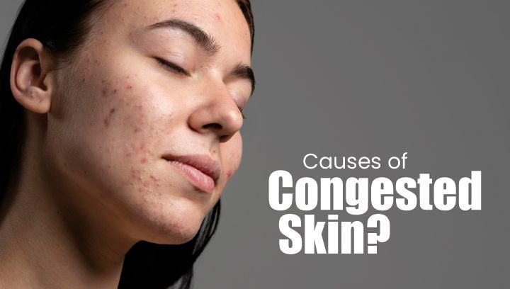 What Is Congested Skin, and How to Prevent It?